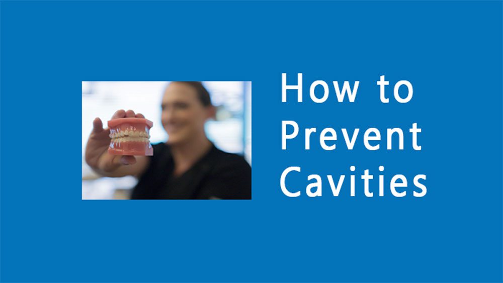 how-to-prevent-cavities