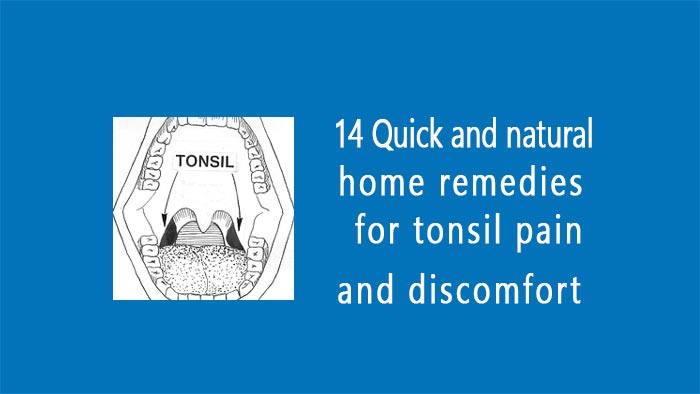 home remedies for tonsil