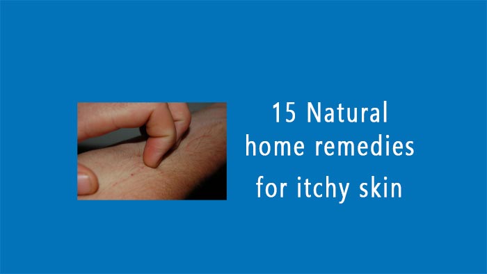 home remedies for itchy skin