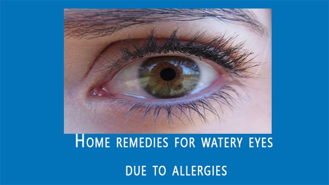 Home remedies for watery eyes
