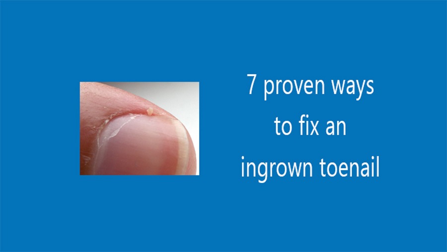 7-proven-ways-to-fix-an-ingrown-toenail